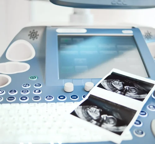 ultrasound_machine_printout ultrasound_machine_printout